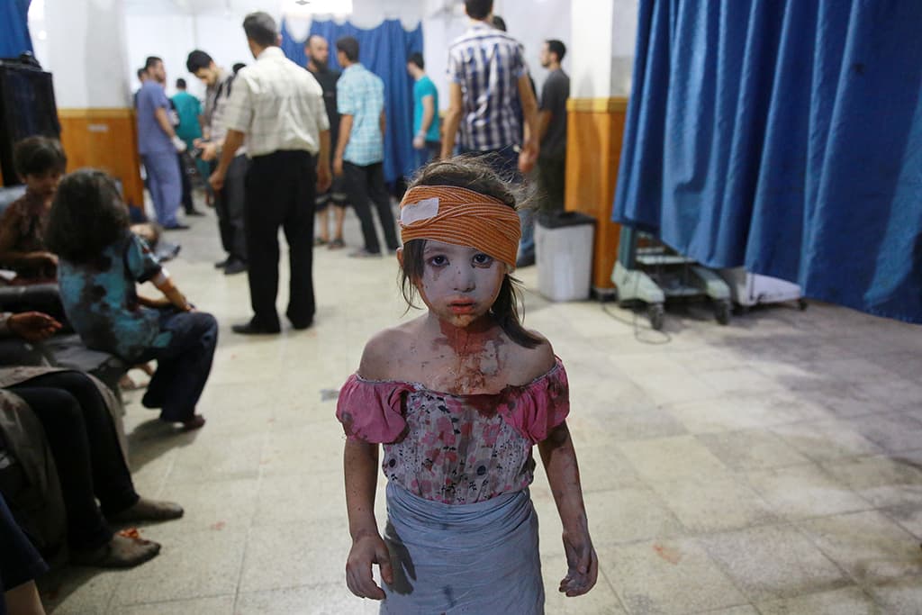 -- AFP PICTURES OF THE YEAR 2015 -- A wounded Syrian girl looks on at a make shift hospital in the rebel-held area of Douma, east of the capital Damascus, following shelling and air raids by Syrian government forces on August 22, 2015. At least 20 civilians and wounded or trapped 200 in Douma, a monitoring group said, just six days after regime air strikes killed more than 100 people and sparked international condemnation of one of the bloodiest government attacks in Syria's war. AFP PHOTO / ABD DOUMANY