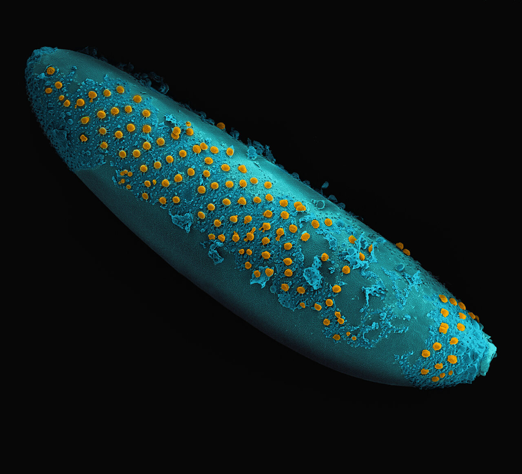 ‘Submarine fever’, 2022
By Jander Matos and Joaquim
Nascimento
Courtesy of Wellcome
Photography Prize 2025