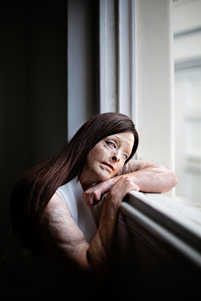 Mel from the series The Outside of the Inside, October 2024 © Martina Holmberg