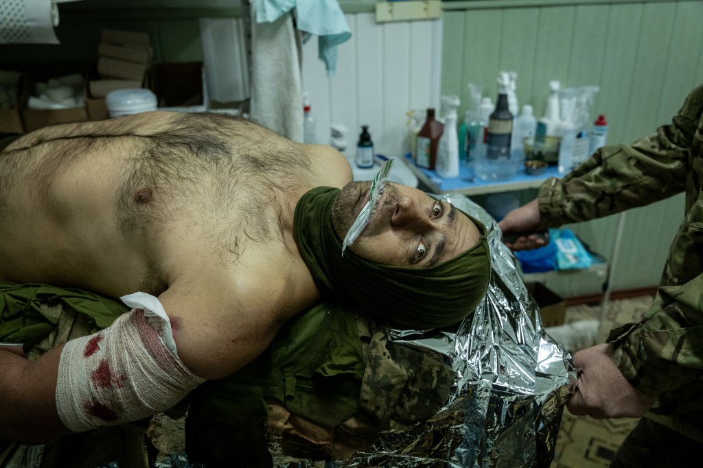 A wounded Ukrainian soldier winced in pain as doctors and medics of the 33rd Mechanized Brigade provided medical attention to attempt to save his leg at stabilization point in the Pokrovsk district, Ukraine, on Saturday, September 21, 2024. Image Credit: Nicole Tung SINGLE USE ONLY
