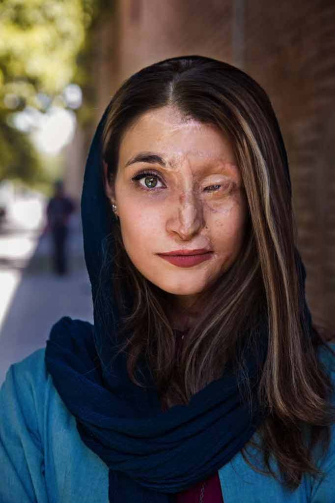Marzieh found the strength to overcome her suffering and fight so this would never happen to another woman. - Isfahan, Iran