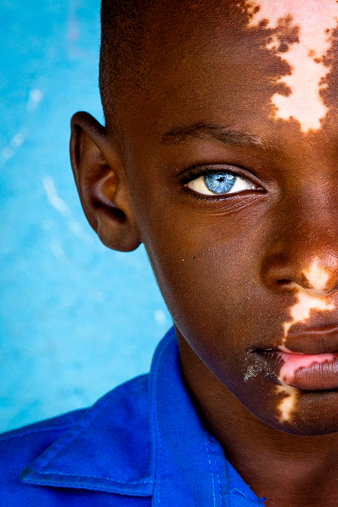 close-up portrait of a boy in blue shirt with light blue eye