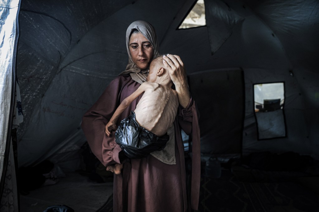 Eighteen-month old Muhammad Zakariya Ayyoub al-Matouq pictured with his mother in Gaza City on July 21. Image Credit: Ahmed Jihad Ibrahim Al-Arini Anadolu/Getty Images