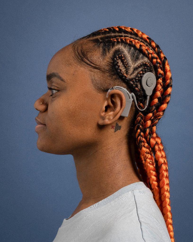 side portrait of a girl with a cochlear implant