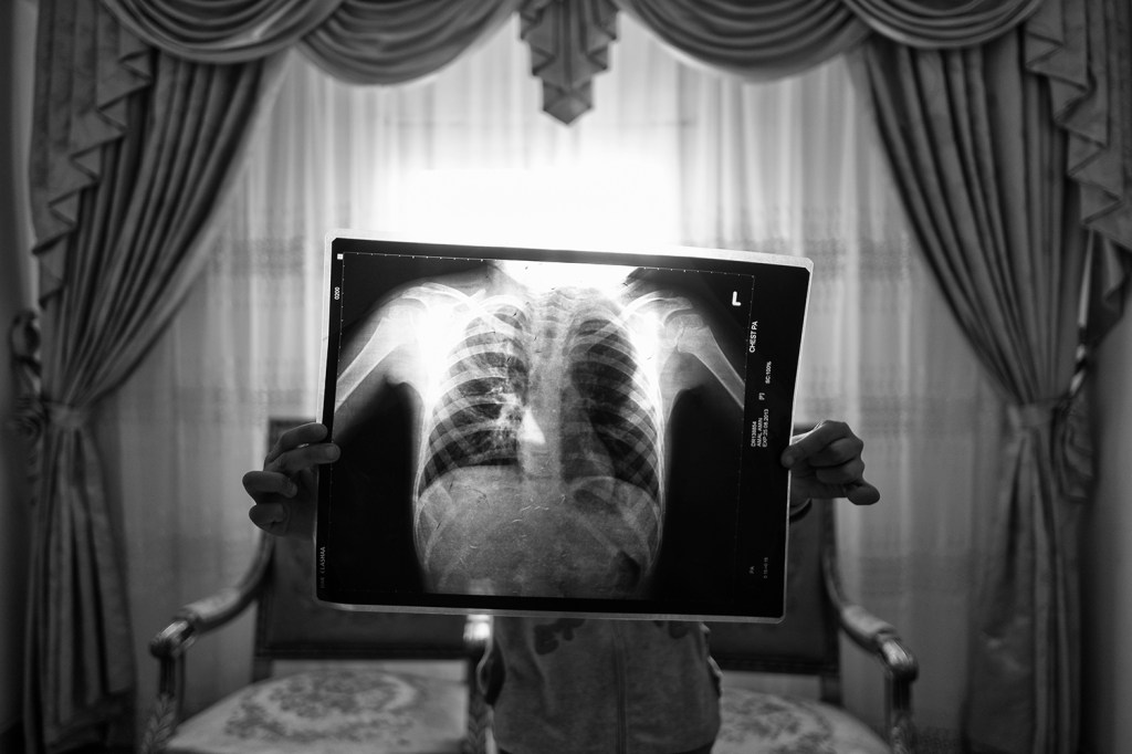 Amal holds an X-ray of her lungs. She moved to Moon Valley at three years old and developed asthma within months. Alexandria, Egypt, 31 January 2018.