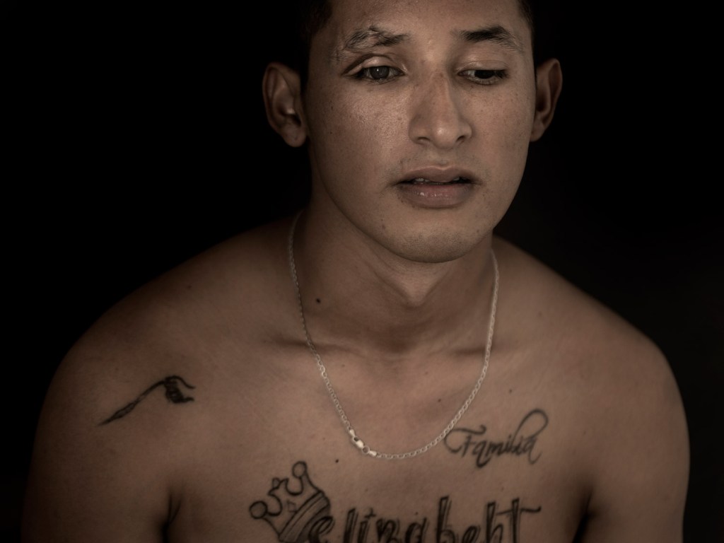 Twenty-five-year-old Jesús Bautista lost one leg and the sight in his left eye when he stepped on a landmine while fighting for the Colombian Army against a drug cartel in the Catatumbo-region, 2026. Image Credit: Mads Nissen