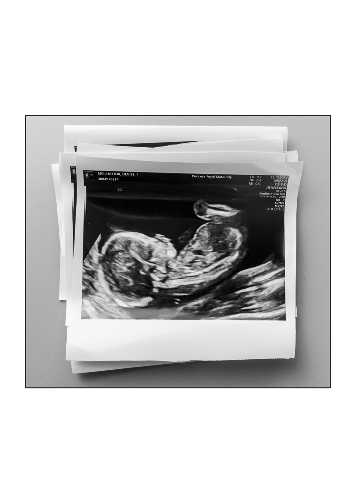 photo of a baby scan