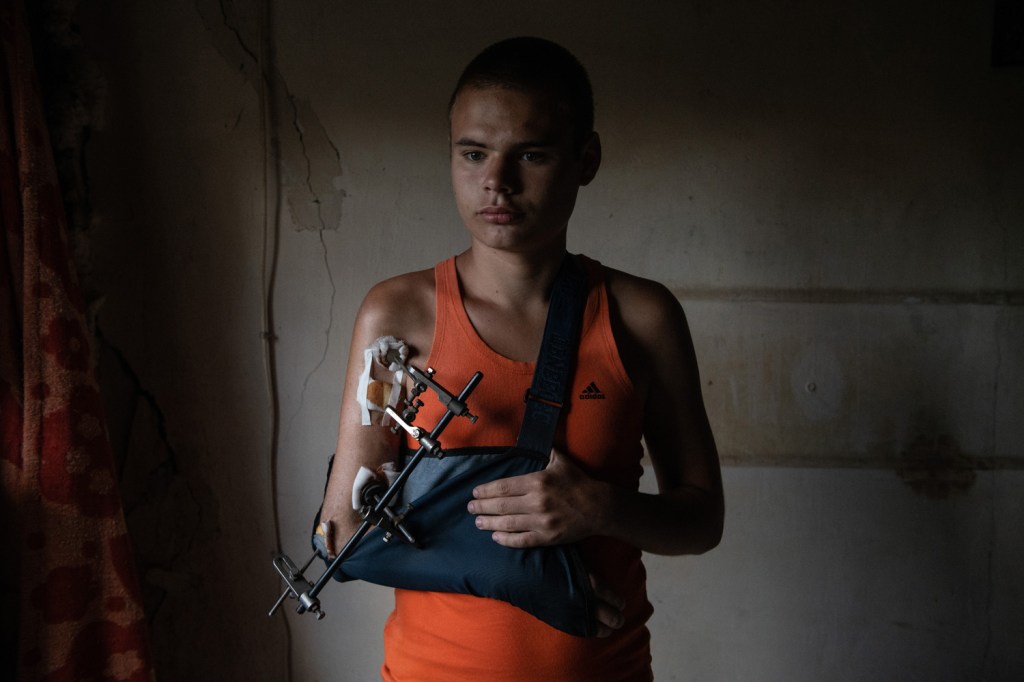  Local resident Daniel (18) was wounded in the arm during a shell explosion near  
his house, Mariupol, Ukraine 2022. From the series “Mariupol – Open Wounds”
© Valery Melnikov/LOBA 2026