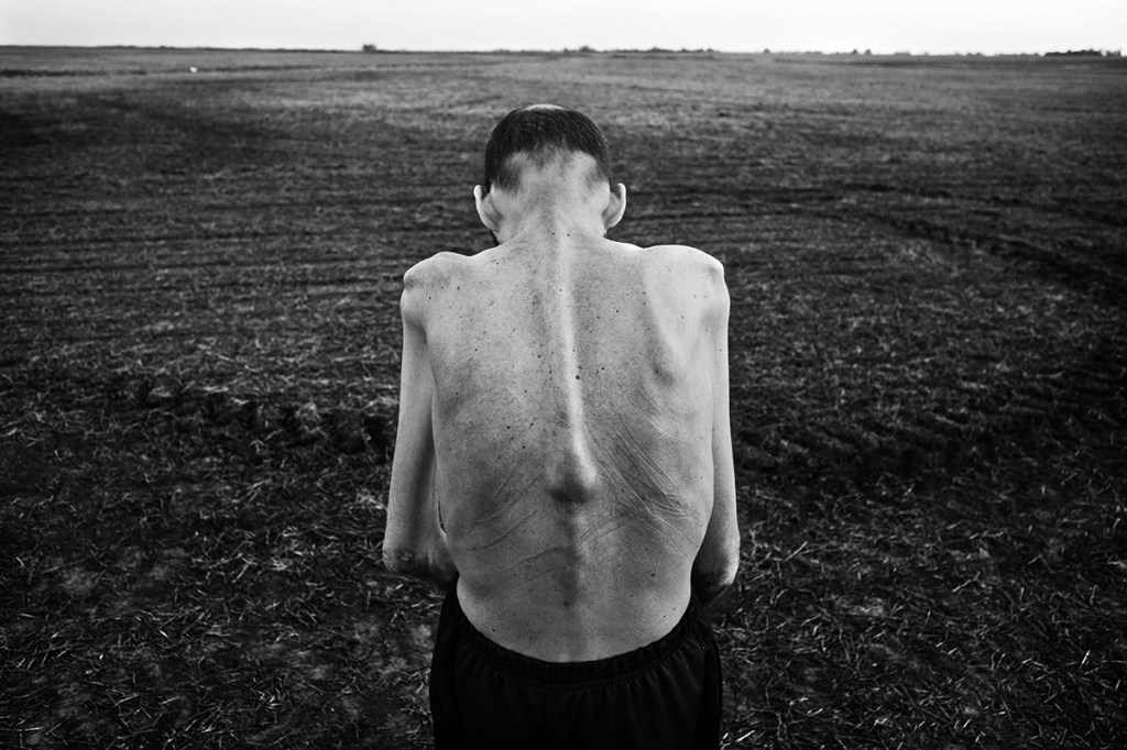 The Human Cost of Agrotoxins
Pablo E. Piovano, Argentina, Manuel Rivera-Ortiz Foundation, Philip Jones Griffiths Foundation, Lawen.doc

