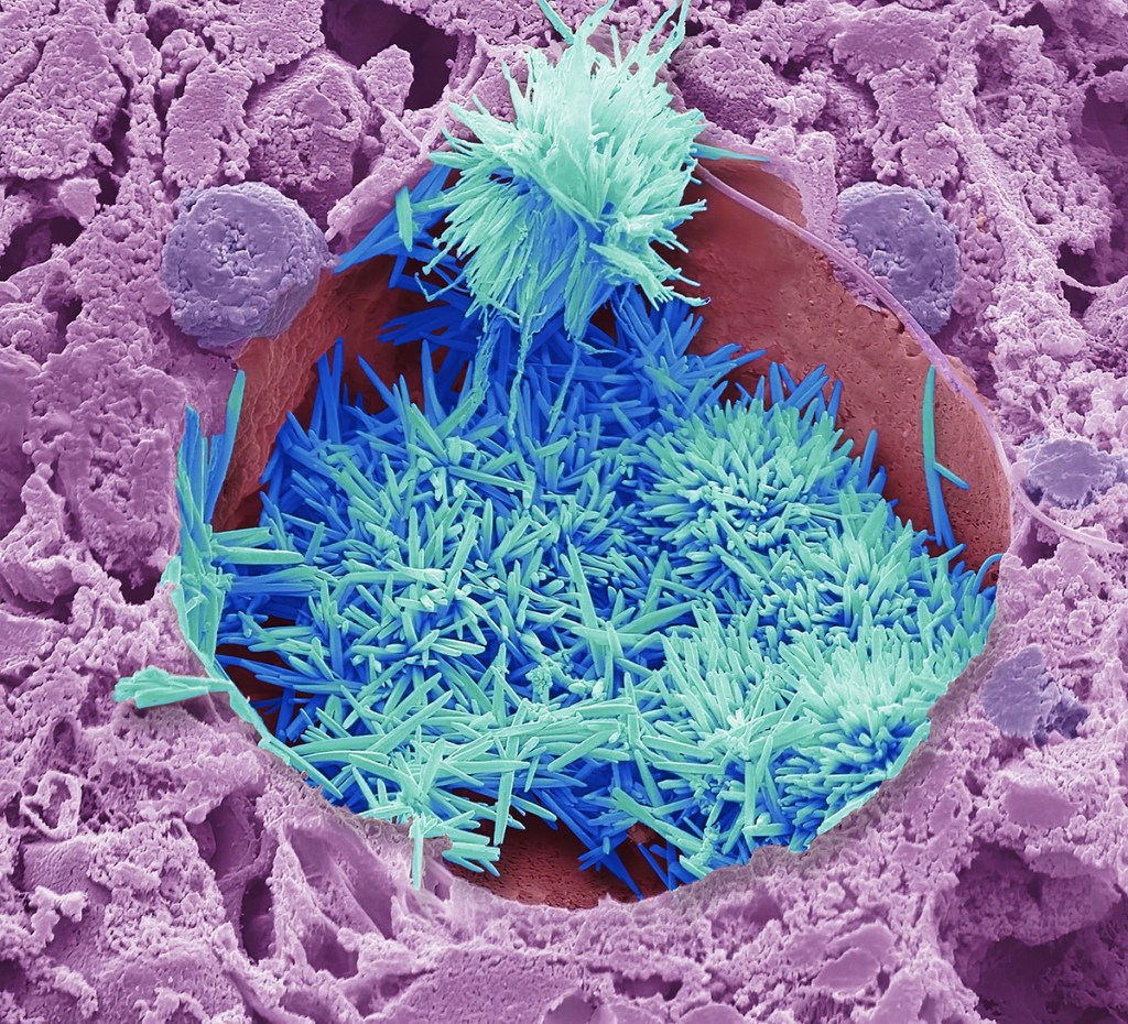 ‘Cholesterol in the liver’, 2022
By Steve Gschmeissner
Courtesy of Wellcome
Photography Prize 2025